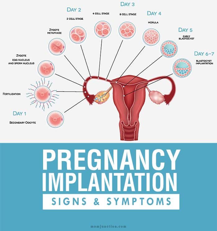 25+ bÃ¤sta Implantation symptoms idÃ©erna pÃ¥ Pinterest