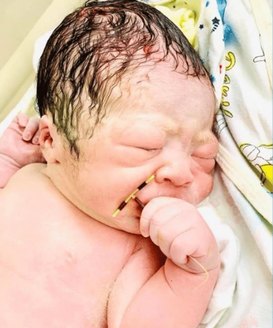 baby holding iud when born