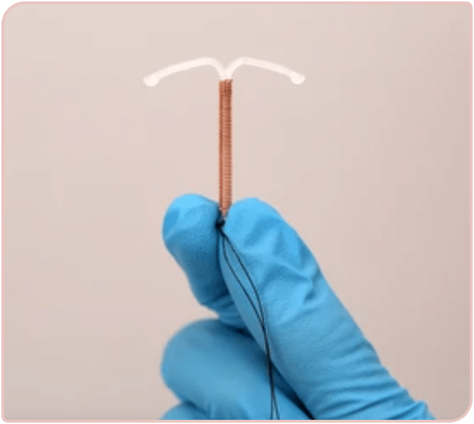 Copper Coil IUD Contraceptive