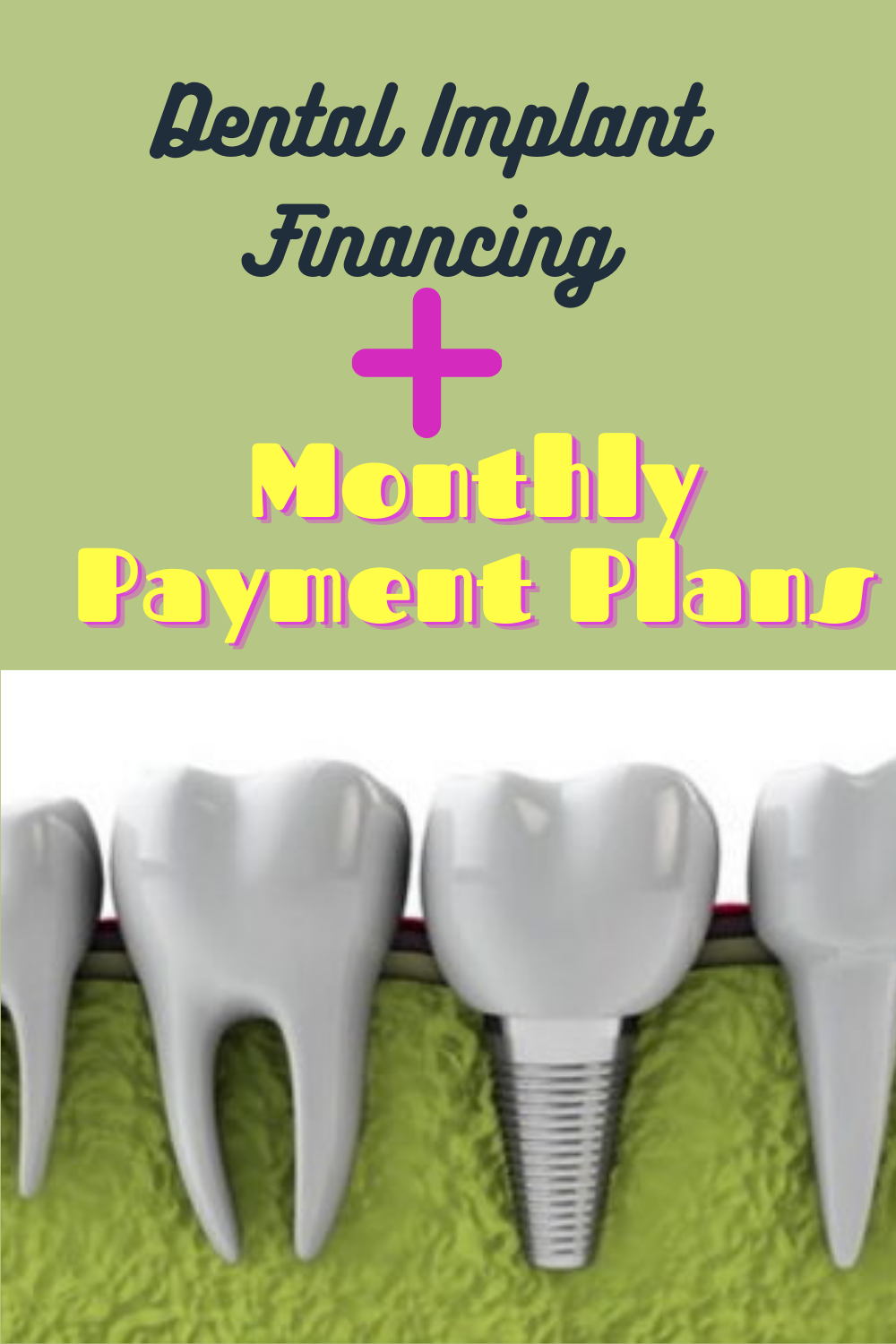 Dental Insurance No Waiting Period For Dentures ...