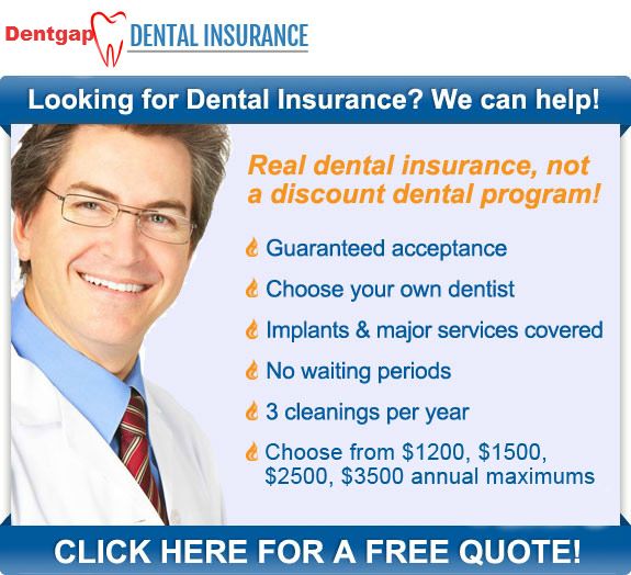Dental Insurance No Waiting Period : Ppo Dental Insurance No Waiting ...