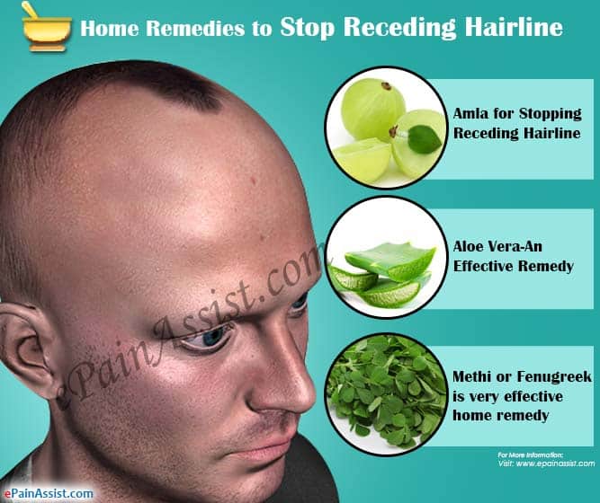 Home Remedies to Stop Receding Hairline
