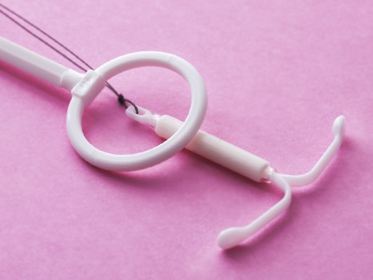 IUD Period: 12 Things to Expect Within the First Year ...