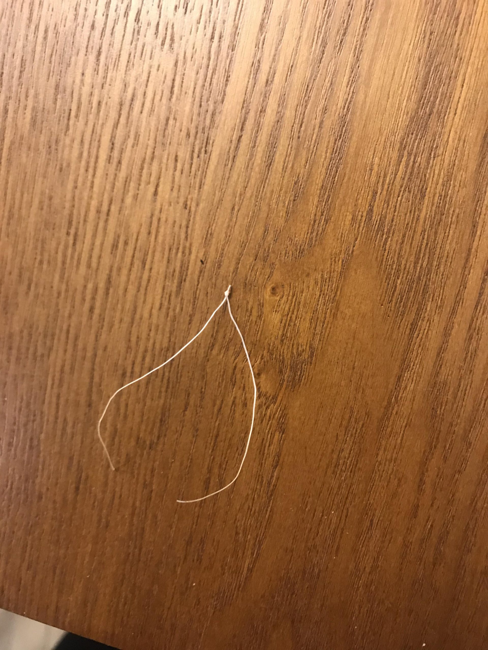IUD string literally fell off. What do I do next? : obgyn