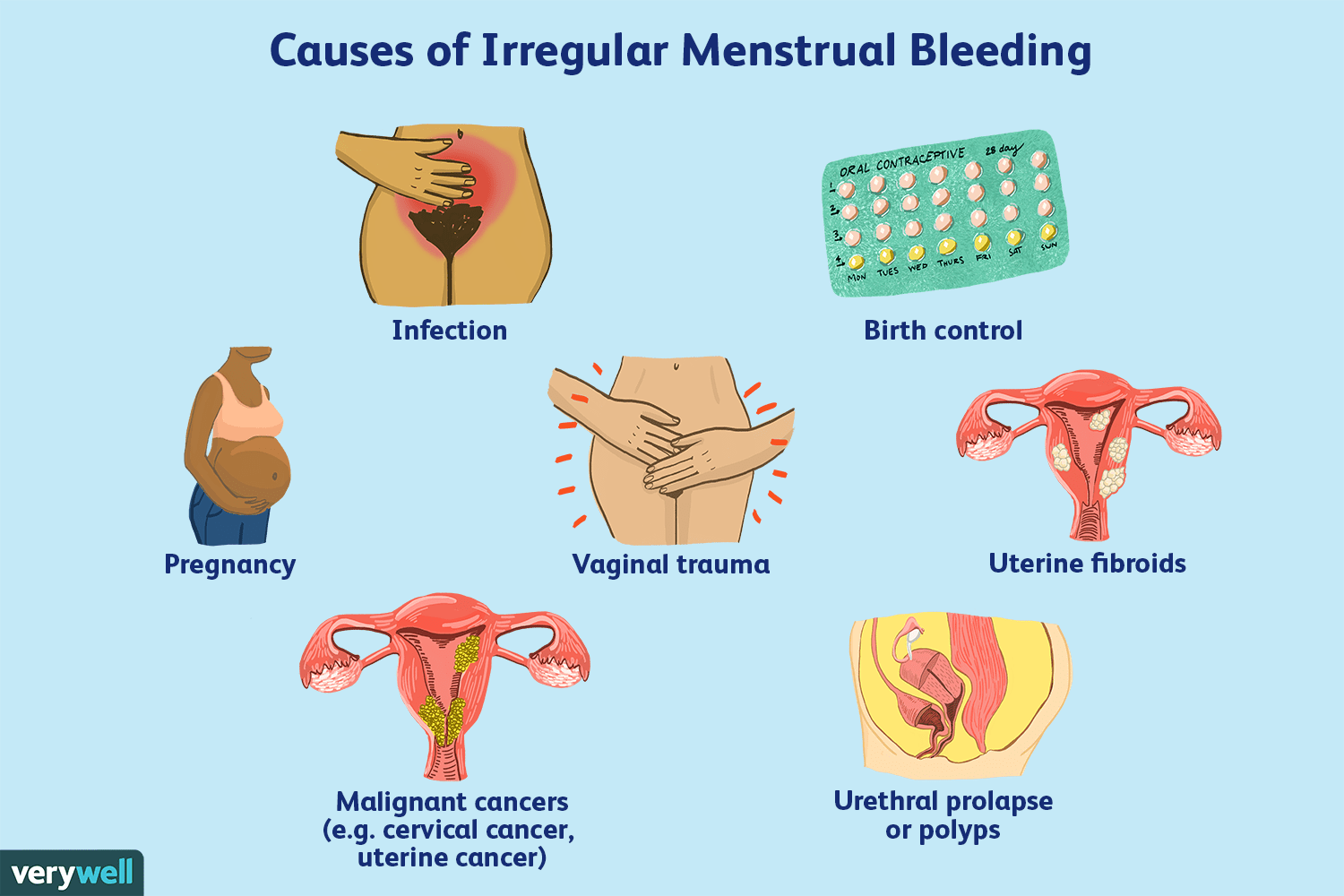 Light Bleeding Between Periods Not Pregnant