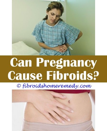 Posterior Fibroid