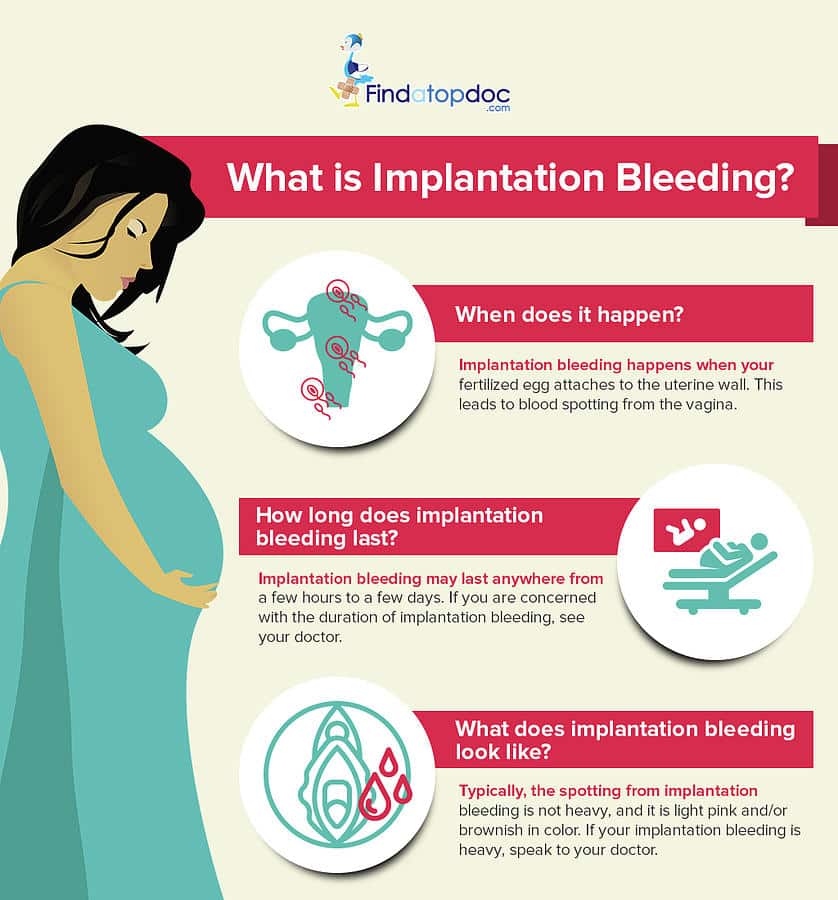 What Is Implantation Bleeding? Photograph by Finda TopDoc